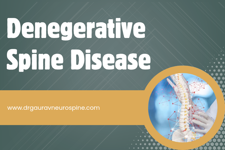 Degenerative Spine Disease treatment in Udaipur